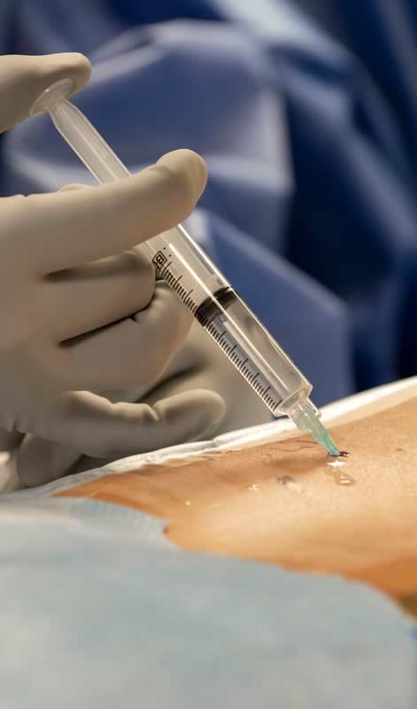 facet joint injection photo